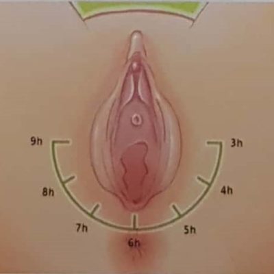 3 (3)